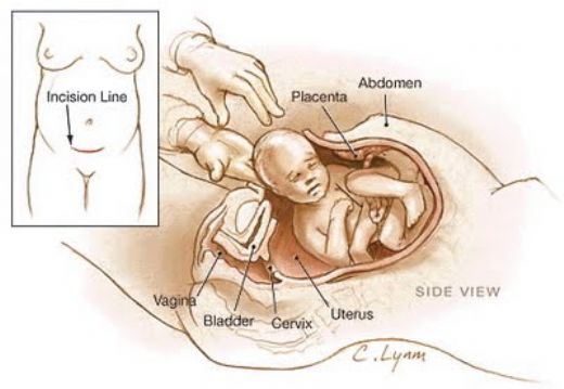 Doğum Sancısı Gelmesi İçin Ne Yapmalı?